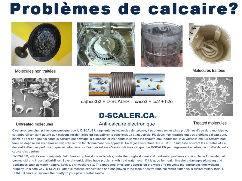 Adoucisseur D'eau Anti Calcaire Magnetique - Aimant Anti Calcaire